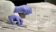 Coronavirus Pandemic: Iran reports 1,178 daily COVID-19 cases, 62,04,224 in total