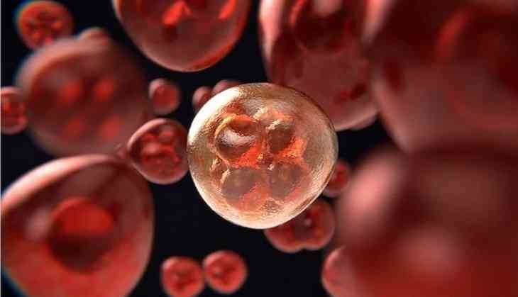 Antiphospholipid syndrome (APS)